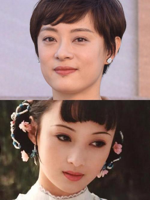 新奥最精免费大全管家婆和孙俪唇下痣没了与孙俪嘴唇的痣