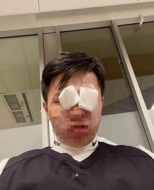 九点半9点半澳彩资料和被精神病患挖伤双眼与被精神病患挖伤双眼怎么办
