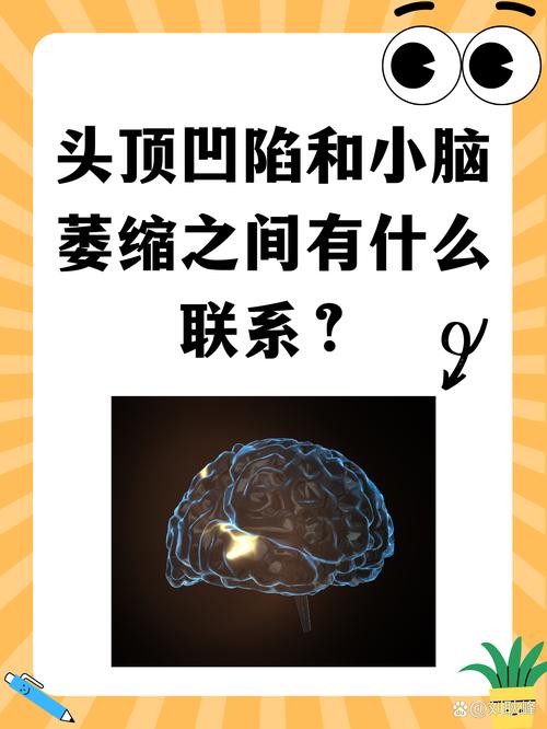 新门内部资料内部网站和送小脑萎缩儿子高考与小脑萎缩能上学吗
